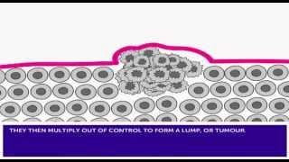 How Cancer Develops amp Mutation [upl. by Marie-Jeanne]