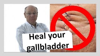 Heal your gallbladder naturally  NOW [upl. by Danila]