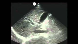 How To Gallbladder Ultrasound Part 1  Introduction Case Study Video [upl. by Teri]