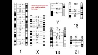 Cytogenetics II Chromosome Analysis amp Karyotypes [upl. by Holli]