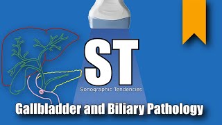 Gallbladder and Biliary Pathology [upl. by Heshum]