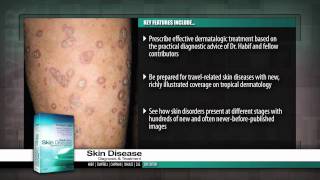 Lyme Disease Treatment  Johns Hopkins 4 of 5 [upl. by Eirovi]