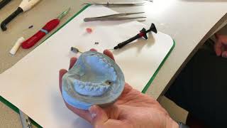 Lab Fabrication of Temporary Implant Crown Nobel Snap In Abutment [upl. by Daisi]