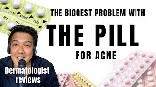 ACNE TREATMENTS  Hormonal Control amp The Pill [upl. by Ezequiel]