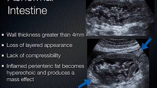 Gallbladder and Intestinal Ultrasound [upl. by Adirf327]