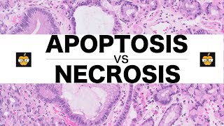 Apoptosis Intrinsic Extrinsic Pathways vs Necrosis [upl. by Bernette]