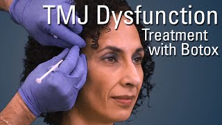 TMJ Dysfunction Treatment with Botox®  Sneak Preview [upl. by Sicnarf]