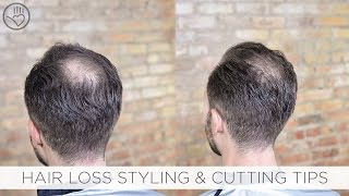 How To Cut amp Style Balding or Thinning Hair [upl. by Britni]