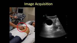 Gallbladder point of care ultrasound tutorial [upl. by Onra3]